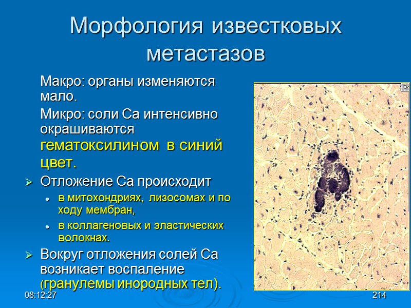 08:12:02 Морфология известковых метастазов  Макро: органы изменяются мало.   Микро: соли Са
